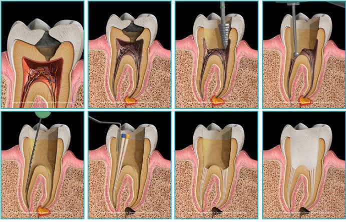 implant anatomisi